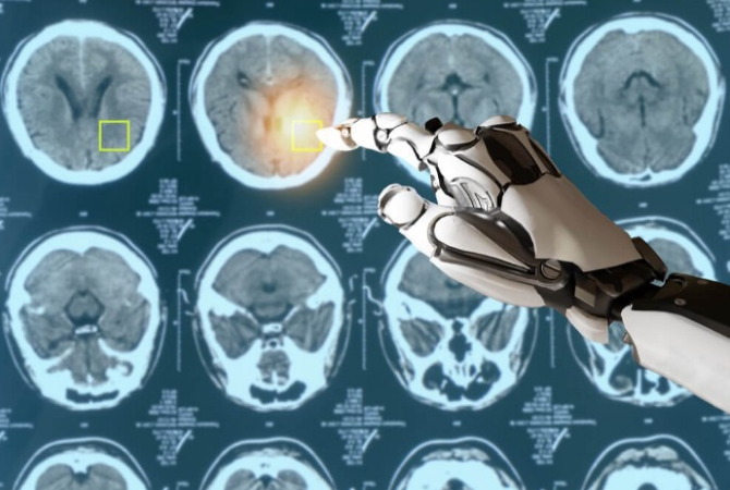 Medical image analysis CNN classifier interface